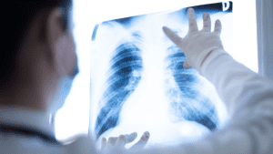 A close-up image of a medical professional placing an x-ray scan of a person