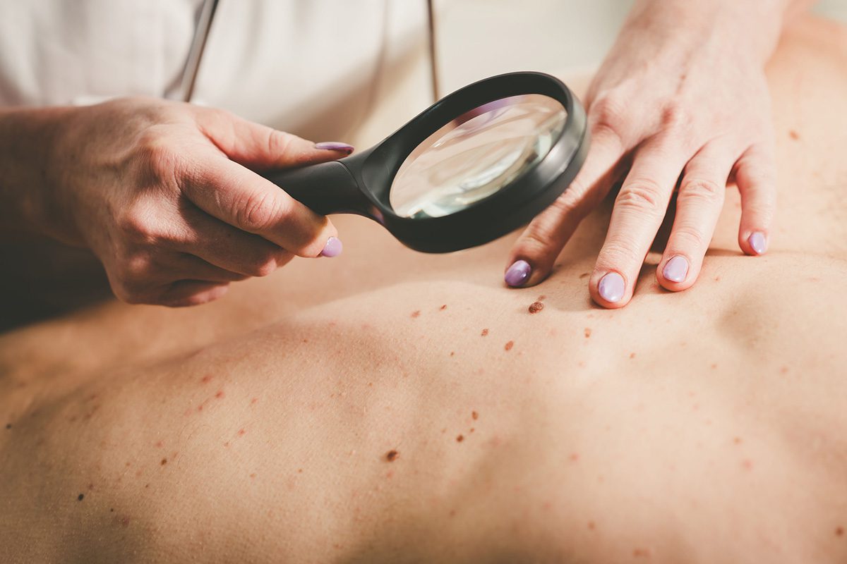 Dermatologist examining the skin of a patient