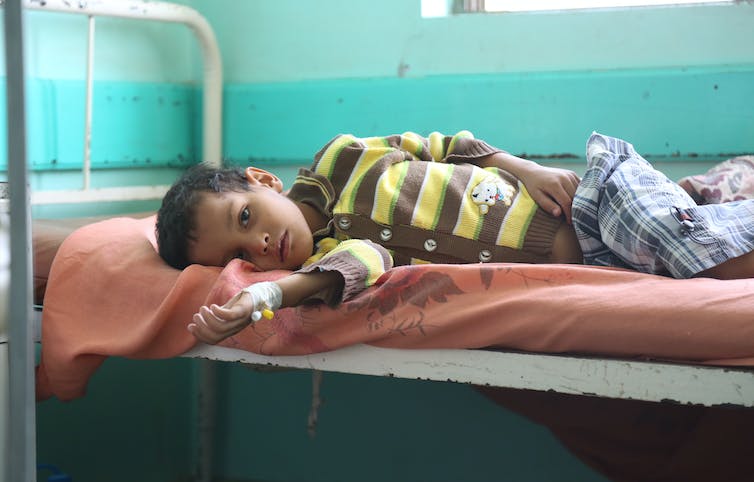 A child suffering from cholera in Yemen in 2017. He is lying on a bed.