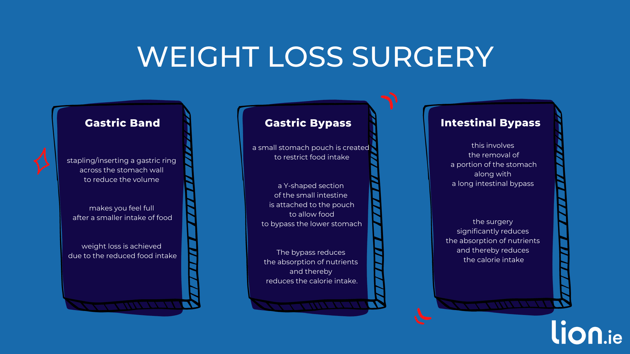 types of weight loss surgery